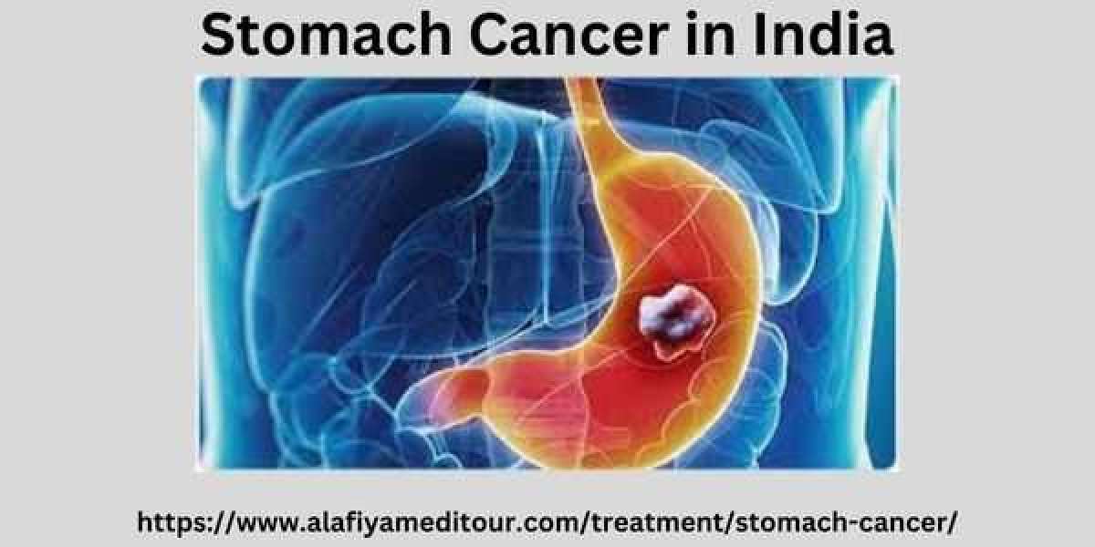 Stomach Cancer in India: Understanding the Challenges and Raising Awareness