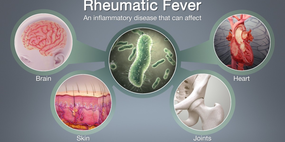 Rheumatic Fever Market Research to Demonstrate Immense Growth Potential with Top Industry Players & Revenue
