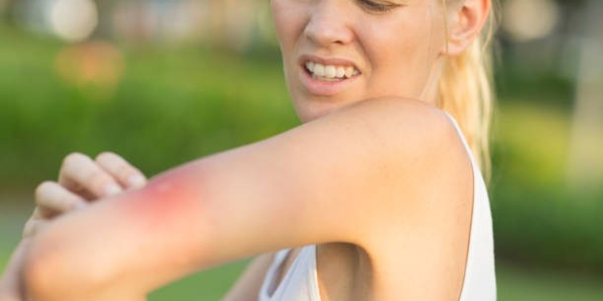 Unveiling Nature's Shield: Gya Labs Insect Repellent - The Best Essential Oils to Repel Mosquitoes