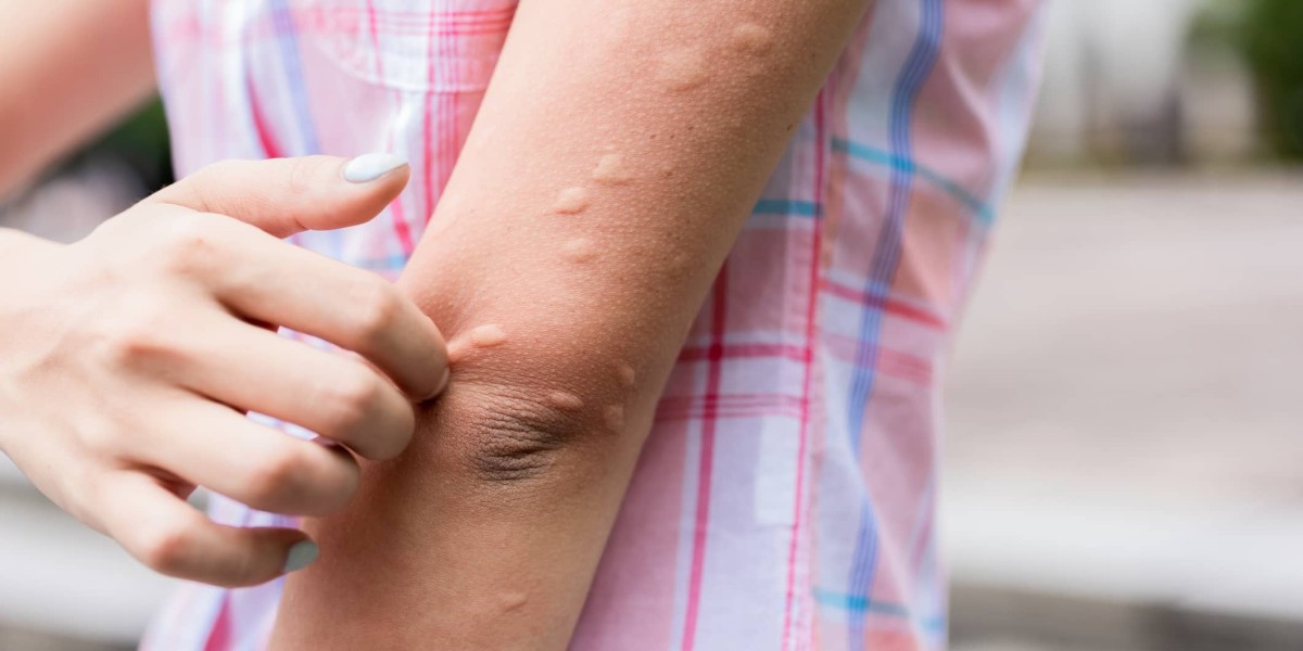 Embrace Nature's Shield: Gya Labs Insect Repellent Essential Oils, Your Natural Mosquito Repellent Solution