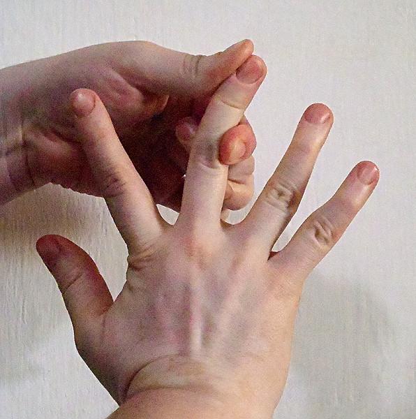 Nostalgic Reflections: 23 Signs You Grew Up with Ehlers-Danlos  - Blog View - Xiglute | Xiglut - Rede Social | Social Network