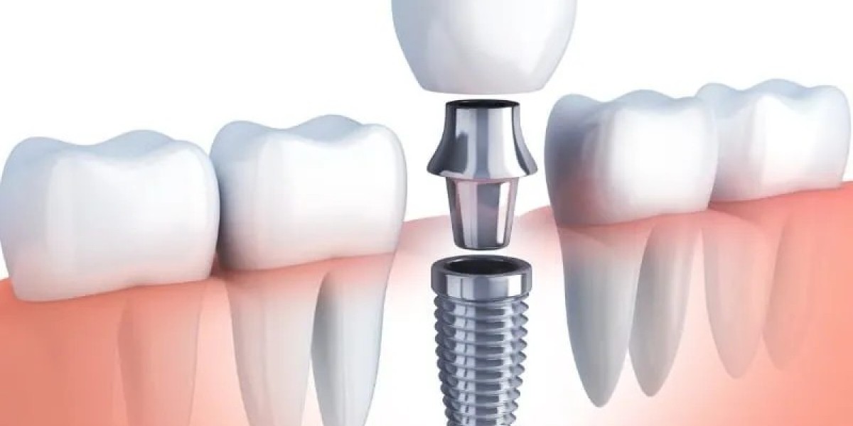 Family Dentistry Services in McKinney Tx