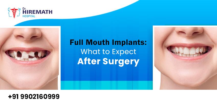 Dr. Vishwannath Hiremath | DENTAL IMPLANTS